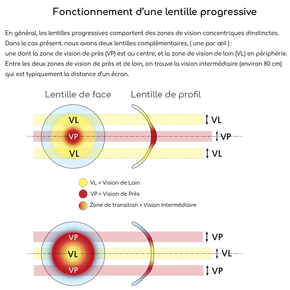 Principe de fonctionnement d’une lentille progressive