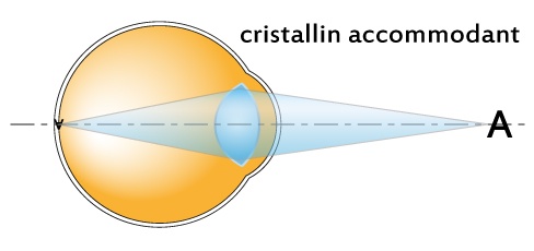 œil_accommodant.jpg